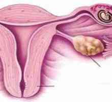 Ztrácí těhotenství: cervikální insuficience