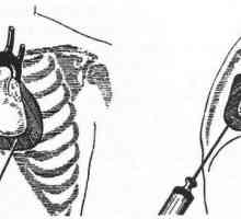 Poškození vnitřních orgánů v poranění hrudníku