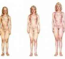 Předčasná puberta u žen: Známky