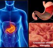 Příčiny chronické gastritidy