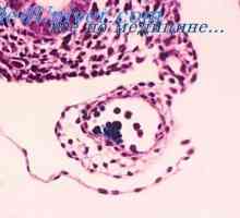 Původ a mikroprostředí buňky. Fibroblasty z lymfatických orgánů