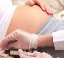 Prolaps mitrální chlopně, léčba těhotných žen