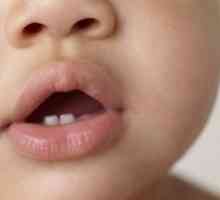 Prořezávání zubů u dětí (děti, kojenci): Příznaky, znaky