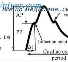Arteriální kolísání pulzní tlak. Změny tlaku pulsu