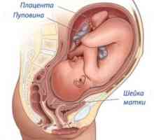 Děložního čípku před porodem příznaky, znaky