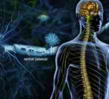 Roztroušená skleróza: Příznaky, léčba, příznaky, příčiny, diagnóza, prevence