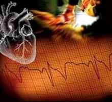 Resuscitace v kardiologii u dospělých