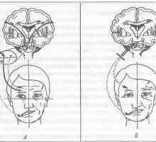 Role lícního nervu v projevech bolesti obličeje