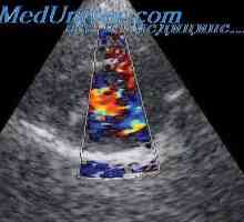 Jádro střídače. ultrazvukové pole