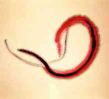 Bilharzie (schistosomiázu, bilharzie), původce krvi (japonsky) Trematode