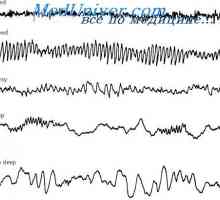 Mozkových vln a úrovně mozková aktivita. Electroencephalogram (EEG) spánek