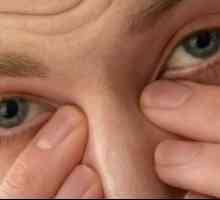 Syndrom suchého oka, léčba, příznaky, příčiny