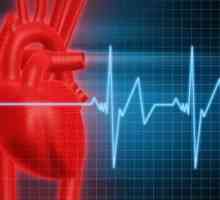 Sinusová tachykardie srdce: léčba, příznaky, příčiny, příznaky