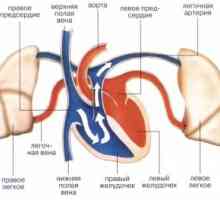 Systémová embolie: příčiny, příznaky, příznaky, léčba
