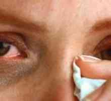 Slzení očí: léčba, příčiny, příznaky, znaky