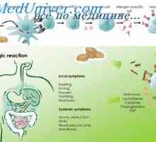 Struktura alergeny. T-buněčné epitopy
