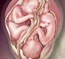 Těhotenství s fotografií dvojčata