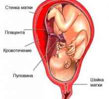 Krvácení v prvním trimestru těhotenství. Proč se zdá, a zda je to normální?