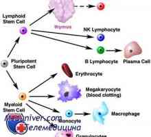 Transplantace kmenových buněk a Hodgkinova lymfomu (Hodgkinova nemoc)