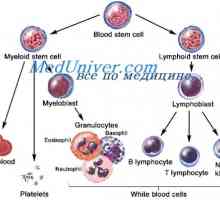 Transplantace kmenových buněk pro akutní leukemie