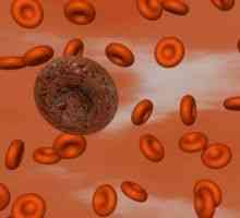 Krevních destiček Poruchy hemostázy, lze identifikovat?