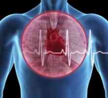 Plicní embolie a akutní srdeční selhání