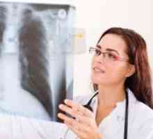 Plicní tuberkulózy v průběhu těhotenství, léčba, symptomy, příčiny