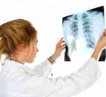 Tuberkulóza periferních lymfatických uzlin