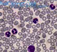 Cytokinové hladiny aktivace dendritických buněk. Produkce cytokinů dendritickými buňkami (DC)