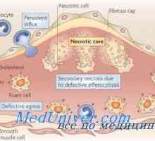 Účinek hypothalamu metabolismu lipidů. Ateroskleróza na diencephalic syndromu
