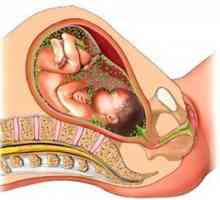 Intrauterinní infekci plodu: Mimochodem, je riziko příčiny, příznaky, symptomy,