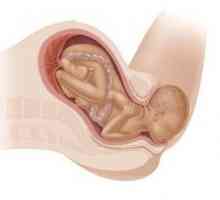 Druhá doba porodní: na začátku, v průběhu zavádění
