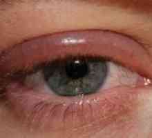 Nemoci století lidské oko: léčba, prevence, příznaky, symptomy, příčiny
