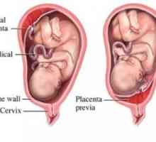 Zpoždění v děloze a placentě jeho částí