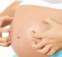 Svědění kůže v průběhu těhotenství v časných i pozdějších fázích: příčiny, léčba