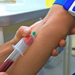 Krevní test na protilátky proti helmintů, parazitární antigeny