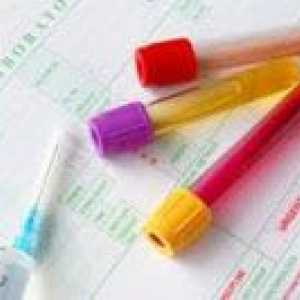 Krevní test pro bakterie přerůstání