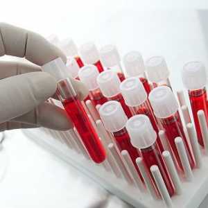 Krevní testy pro opistorhoz (IFA, biochemie), protilátky (atm)