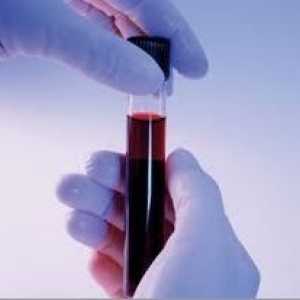 Biochemická analýza krve pro pankreatitidy
