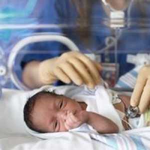 Bronchopulmonální dysplazie u předčasně narozených dětí: Důsledky ošetření