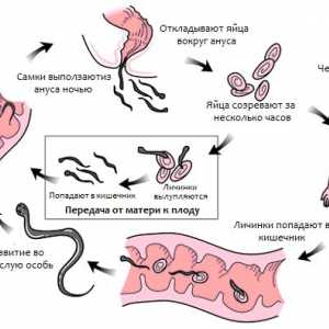 Časté infekce (červ zamoření) roupy (enterobiózy) man