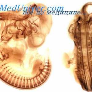 Fetální hlavových nervů. Vývoj hlavových nervů embrya