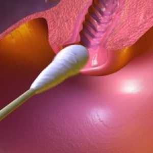 Cytologické vyšetření děložního hrdla