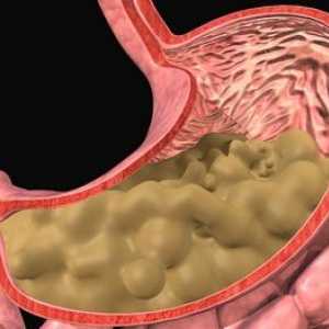 Fibrinózní gastritidu
