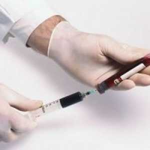 Hemofilie: léčba, příznaky, příčiny, příznaky