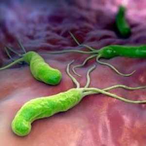 Infekce Helicobacter pylori: léčba, příznaky, příčiny, diagnostika, symptomy