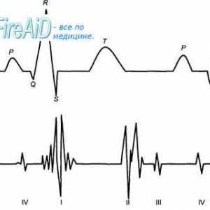 Srdeční ozvy. První (systolický) srdeční zvuk. Druhá (diastolický) srdeční zvuk. Phonocardiogram.