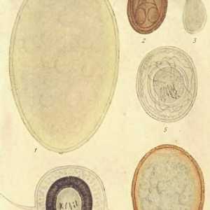 Finové vajíčka, larvy, solium cysty (tasemnice)
