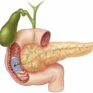 Erozivní a ulcerózní duodenitis