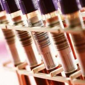 Jaké testy krve předat onemocnění slinivky?